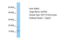 GLIPR2 Rabbit anti-Human, Polyclonal, Novus Biologicals 0.1 mL | Buy Online | Novus Biologicals | Fisher Scientific